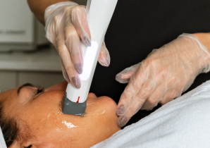 Face & Skin Tightening